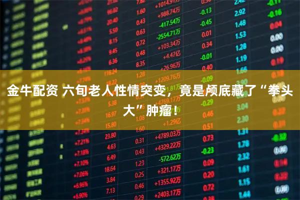 金牛配资 六旬老人性情突变，竟是颅底藏了“拳头大”肿瘤！